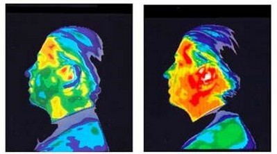 Irradiazione del cervello (immagine a destra) con l'uso del telefono cellulare.