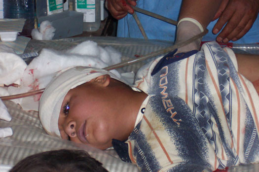 un bambino iracheno colpito dai cecchini USA