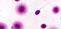 Frammentazione del DNA dello sperma: un marker precoce e affidabile dell'inquinamento atmosferico