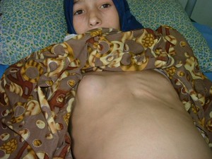 Bambina di 10 anni, affetta da linfoma non-Hodgkin, attualmente ricoverata a Bassora