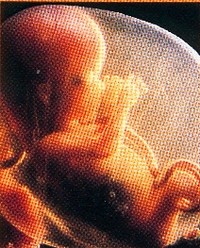Immagine a colori di un feto a quattro mesi